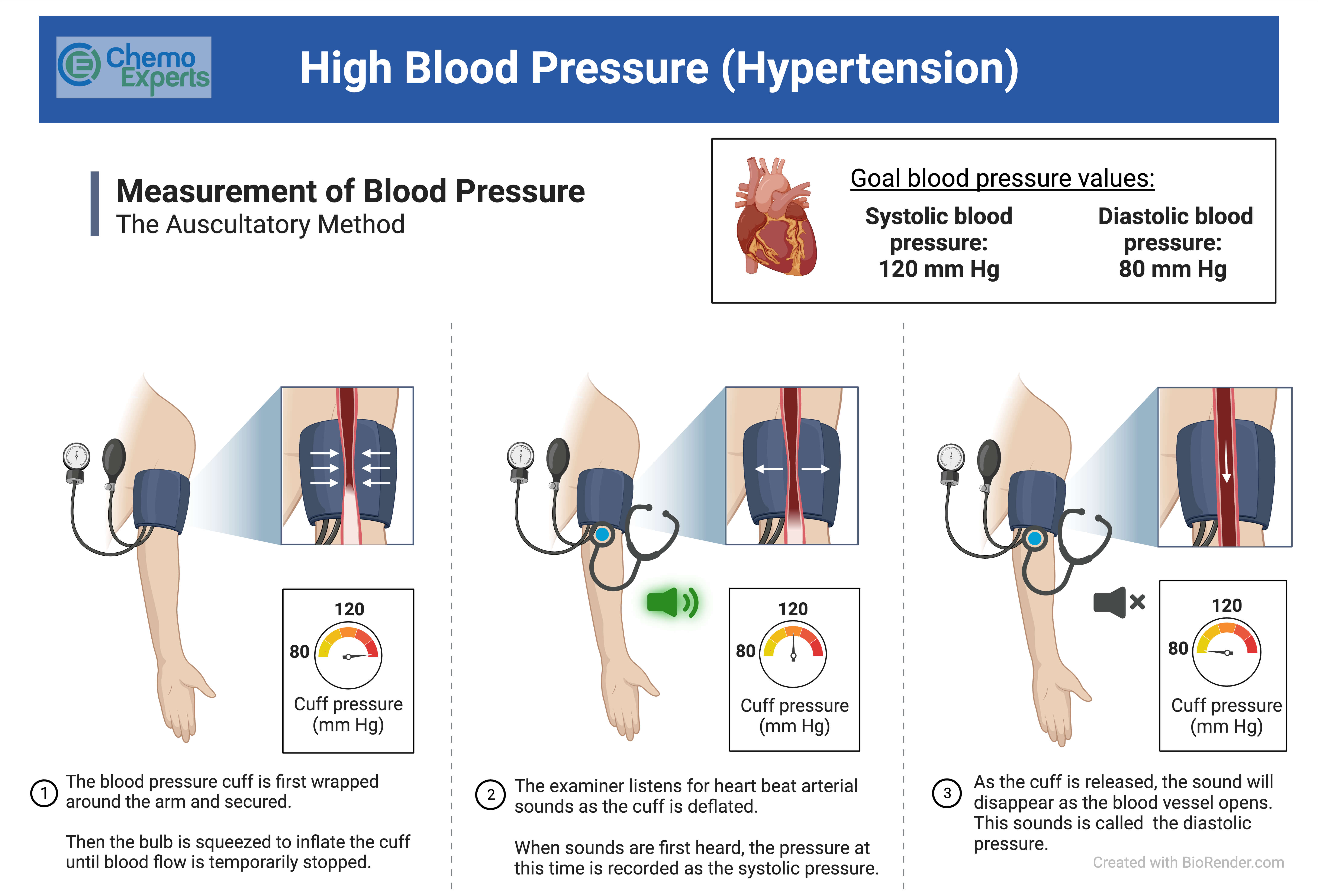 High Blood Pressure ChemoExperts